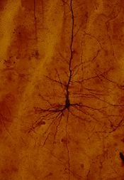 photomicrographs